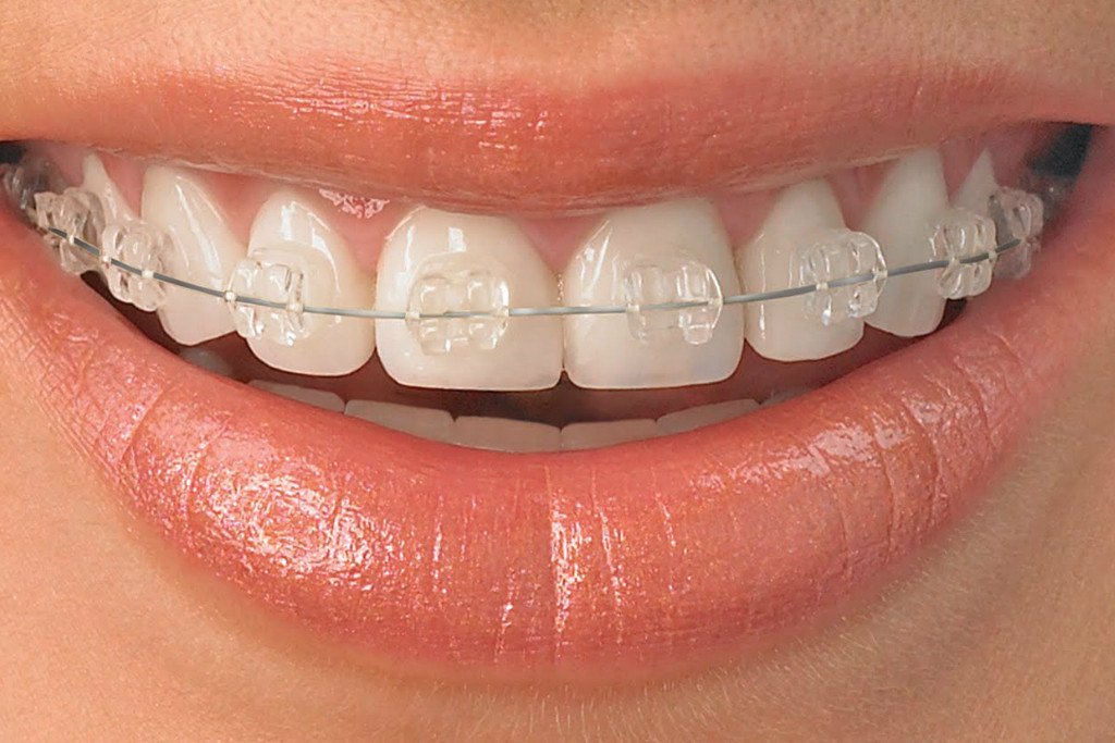 Light Dental Studios