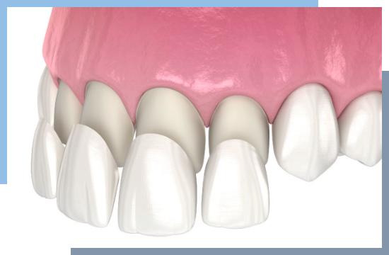 Light Dental Studios