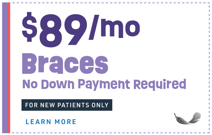 offer-89-mo-braces-no-down-payment