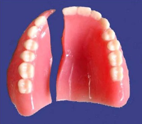 broken-dentures-light-dental-stu