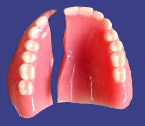 broken-dentures-light-dental-stu Light Dental Studios