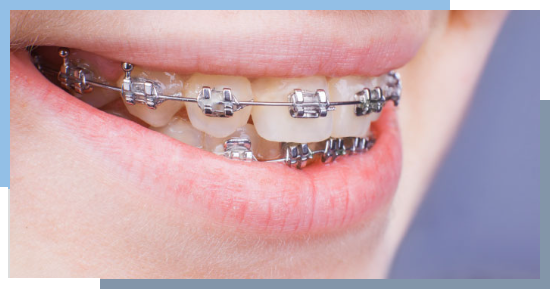 Light Dental Studios