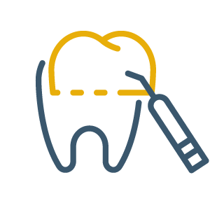 Cosmetic Bonding