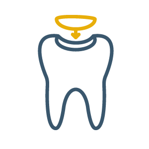 Composite Fillings