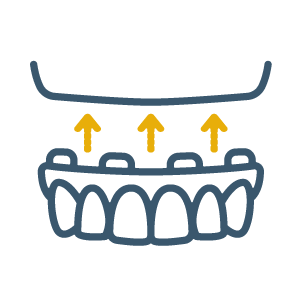 In-House Denture Lab