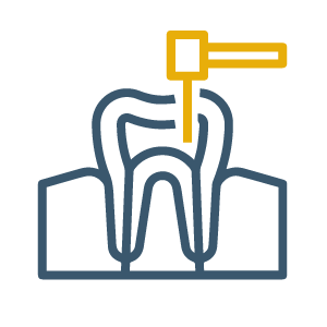 Root Canals