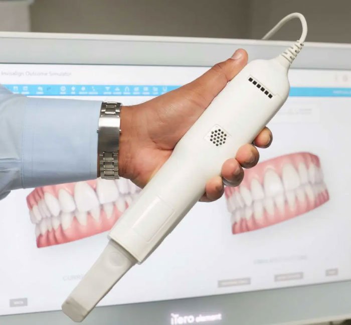 itero for Invisalign
