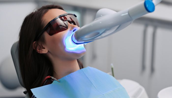 Teeth Whitening